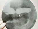 LED ZEPPELIN LEMON SONG X-Ray USSR Record Roentgen Bones Ribs Music Vinyl