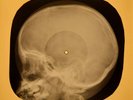 Bob Dylan - Lay Lady Lay  X-RAY OF THE USSR X-RAY BONES RECORD