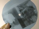ROLLING STONES RUBY TUESDAY X-Ray USSR Record Roentgen Bones Ribs Music Vinyl