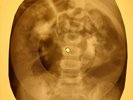 Big Mama Thornton - Hound Dog  X-RAY OF USSR X-RAY BONE RECORD