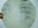 X-RAY 78rpm PETER LESHCHENKO Russian Tango USSR ROENTGEN BONES Ribs Thorax 1950s
