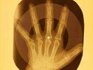 Elvis Presley - That's All Right Mama X-RAY OF USSR X-RAY BONE RECORD