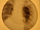 Elvis Presley - Anyplace is Paradise X-RAY OF THE USSR X-RAY BONE RECORDING