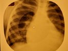 Beatles - I Need You X-RAY OF THE USSR X-RAY BONE RECORD