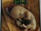 LP FRANCO BATTIATO - FETUS - BLA BLA STEREOMONO BBXL 10001 / 1972 - OTTIMO