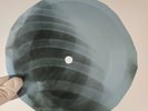 BLUE MINK MELTING POT X-Ray USSR Record Roentgen Ribs Bones Music Vinyl