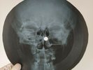 PINK FLOYD ASTRONOMY DOMINE X-Ray USSR Record Roentgen Ribs Bone  Music Vinyl