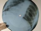 LED ZEPPELIN MOBY DICK X-Ray USSR Record Roentgen Bones Ribs Music Vinyl