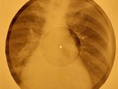 Bob Dylan - Like A Rolling Stone X-RAY OF THE USSR X-RAY BONES RECORDS
