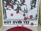 INFEST “Not Over Yet” 1994 EP Red Wax - Unreleased Demo SPAZZ Power Violence