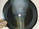 ROLLING STONES POISON IVY X-Ray USSR Record Roentgen Bones Ribs Music Vinyl