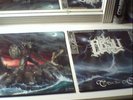 ABSU BUNDLE LPS