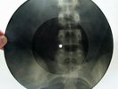 X-RAY 78rpm KATYNA RANIERI Canzone da due soldi USSR ROENTGEN BONES Spine 1950s