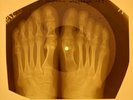 Everly Brothers - Cathy's Clown X-RAY OF THE USSR X-RAY BONES RECORD