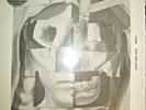 Lorn - Ask The Dust (2012 Ninja Tune) 2 LP Vinyl Limited Edition, Clear Clouded