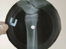 BEATLES PLEASE PLEASE MRS POSTM X-Ray USSR Record Roentgen Ribs Bone Music Vinyl
