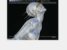 The Weeknd - ECHOES OF SILENCE 2LP DELUXE SORAYAMA EDITION Vinyl LP Pre Order