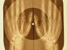 Doors - You Make Me Real X-RAY OF THE USSR X-RAY BONES RECORDING
