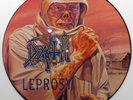 DEATH Leprosy 12
