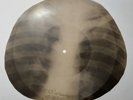 Shadows - Apache X-RAY OF THE USSR X-RAY BONE RECORDS
