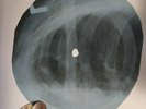 BEN E KING WHAT IS SOUL X-Ray USSR Record Roentgen Bones Ribs Music Vinyl