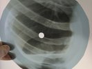 CHRIS ANDREWS YESTERDAY MAN X-Ray USSR Record Roentgen Bones Ribs Music Vinyl