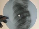 LED ZEPPELIN MOBY DICK X-Ray USSR Record Roentgen Bones Ribs Music Vinyl