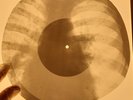 Lots 6 pieces X-RAY OF THE USSR X-RAY BONES RECORDING