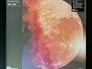 Kid Cudi ‎–  Man on the Moon: The End of Day - 2LP (Vinyl Me Please VMP) - NEW