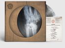 Kasabian - The Alchemist’s Euphoria - Vinyl Picture Disc Bones Music Edit