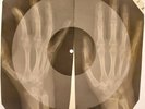 David Bowie - After All X-RAY HANDS BONES RECORDS USSR 61