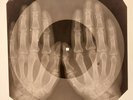 Velvet Underground - I'm Set Free  X-RAY HANDS BONES RECORDS USSR 200