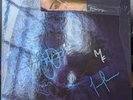 FEAR INOCULUM (LIMITED EDITION VINYL) - SIGNED