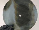 DAVID BOWIE ALL THE MADMEN X-Ray USSR Record Roentgen Bones Ribs Music Vinyl