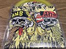 Agoraphobic Nosebleed/ANS - Tribute to Gang Green(vinyl 5