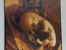 Franco Battiato - Fetus LP ROCK  Bla Bla Sony Music SERIE Prog Rock Italiano 48