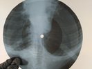 LED ZEPPELIN SINCE I'VE BEEN L X-Ray USSR Record Roentgen Bones Ribs Music Vinyl