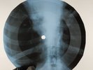 LED ZEPPELIN MOBY DICK X-Ray USSR Record Roentgen Bones Ribs Music Vinyl