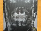 Travis Scott Utopia Vinyl Cover 5 Limited Edition