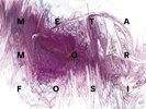 Joseph Capriati - Metamorfosi The Remix Colle (Vinyl 3LP - 2022 - EU - Original)