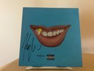 SIGNED - Kyle Smyle. Vinyl. LP. 2-LP's. Used. Limited White Vinyl