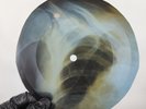DAVID BOWIE SAVIOUR MACHINE X-Ray USSR Record Roentgen Bone Ribs Music Vinyl