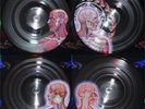 Tool - Lateralus - 2x Picture Disc Vinyl  Record