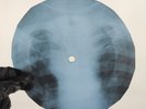 ROLLING STONES RUBY TUESDAY X-Ray USSR Record Roentgen Bones Ribs Music Vinyl