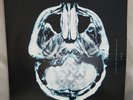 Breaking Benjamin - Dear Agony - Vinyl LP Album RARE (500 Print Run) - OOP