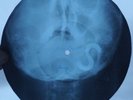 PINK FLOYD - MONEY - UNIQUE USSR GEORGIAN X-RAY SKULL BONES RECORD - LISTEN