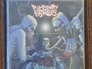 Pulmonary Fibrosis Idiopathic Pulmonary Fibrosis Vinyl Mesrine Oxidised Razor