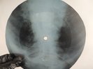 LED ZEPPELIN BLACK DOG X-Ray USSR Record Roentgen Bone Ribs Music Vinyl