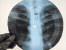 ELVIS ITS NOW OR NEVER X-Ray USSR Record Roentgen Bone Ribs Music Vinyl