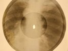 X-RAY USSR ROENTGEN BONES RECORD ORIGINAL OLD RIBS 585